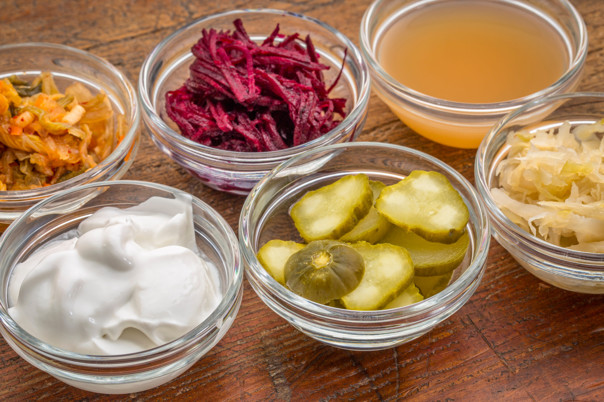 Top 10 Fermented Foods for Gut Health